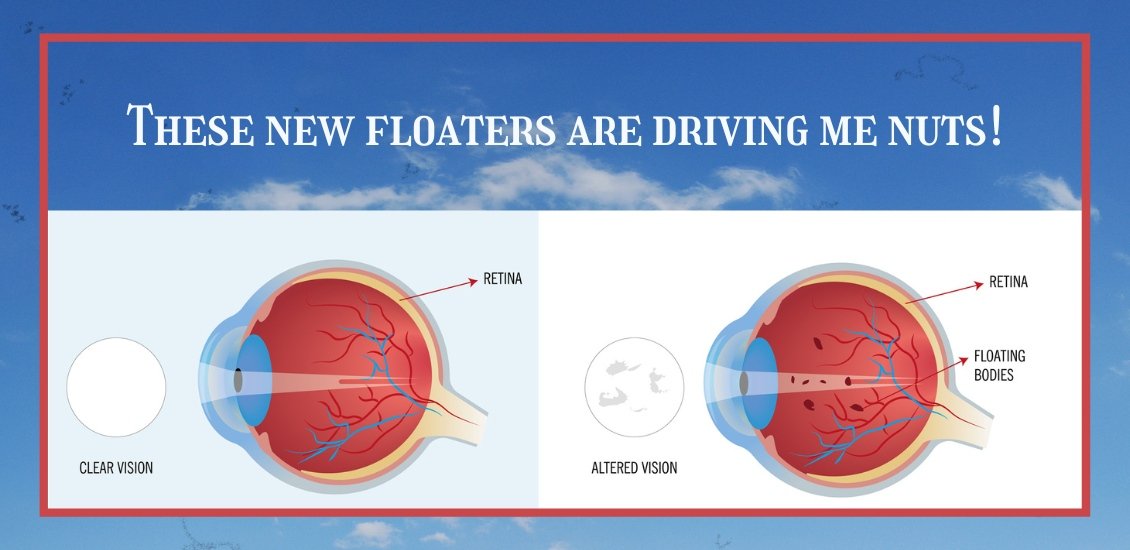 Scientific eye circulation view